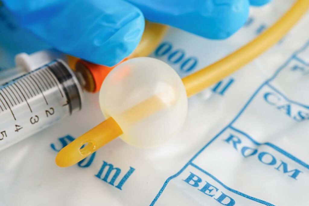 Close-up of a foley urinary catheter with a urine bag.