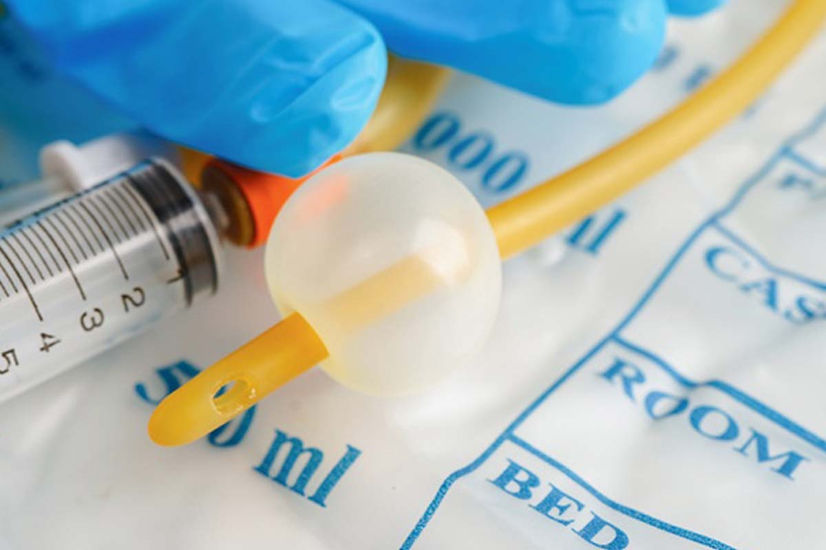 Close-up of a foley urinary catheter with a urine bag.